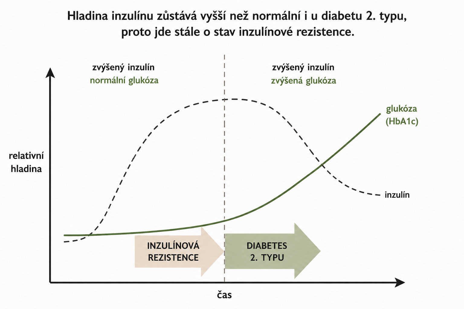 Graf s křivkami inzulínu a glukózy, šipkami k inzulínové rezistenci a diabetu 2. typu.